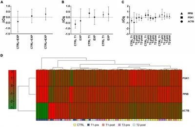 Impact of 12-Week Moderate-Intensity Aerobic Training on Inflammasome Complex Activation in Elderly Women